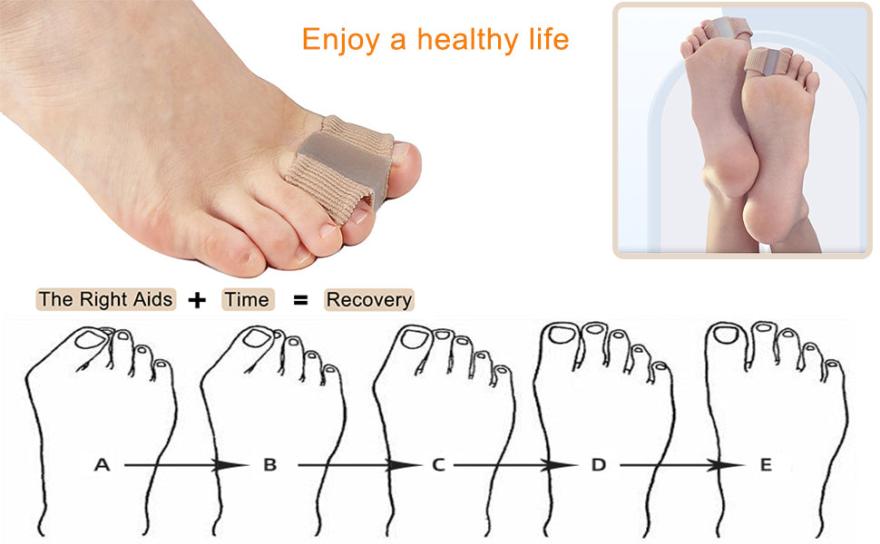 🎁🌈Bunion Toe Separator for Overlapping Toes for Women Men